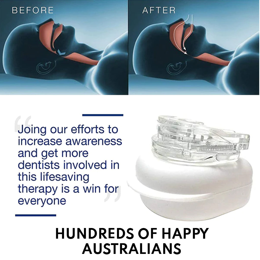 Dispositivo Antisnore SilentForm – Ajustable, Confort Optimizado, Solución Efectiva para el Sueño