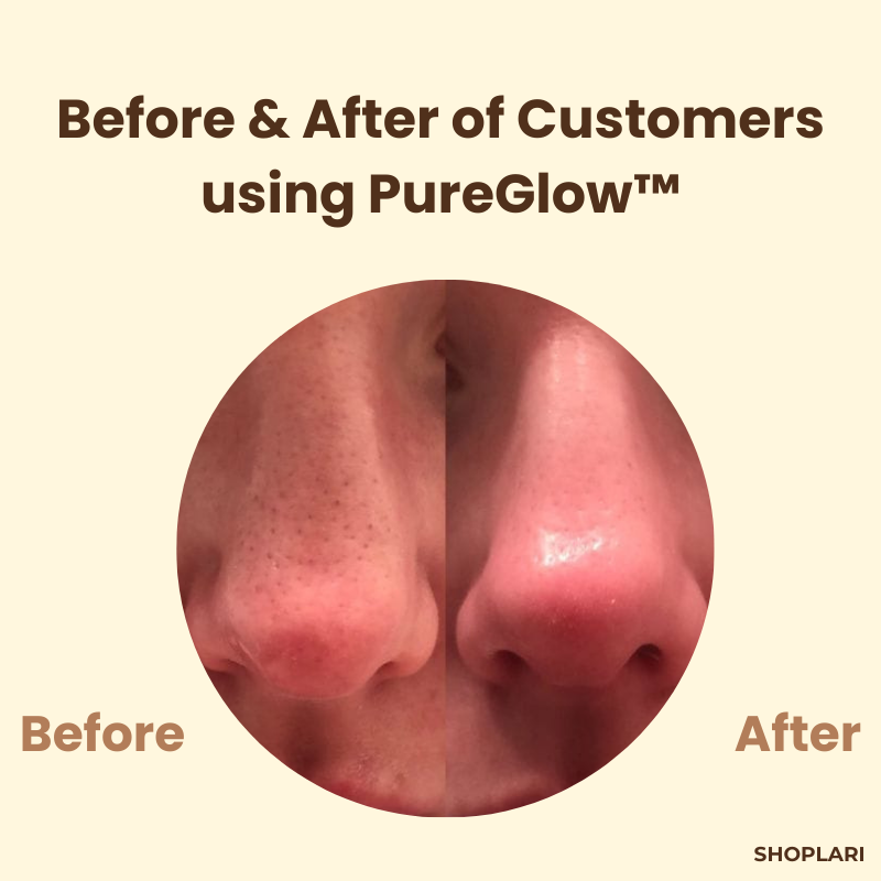 1+1 Gratis Mascarilla de Té Negro PureGlow™