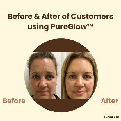 1+1 Gratis Mascarilla de Té Negro PureGlow™