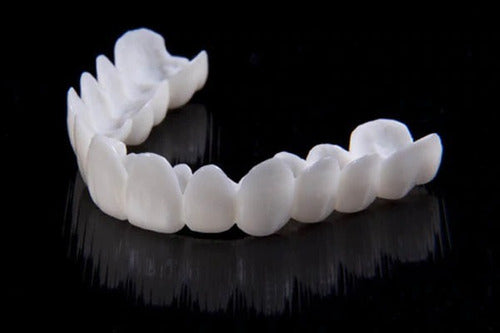 Carillas Dentales DentAlign – Ajuste Natural y Comodidad