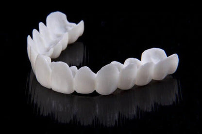 Carillas Dentales DentAlign – Ajuste Natural y Comodidad