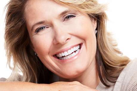 Carillas Dentales DentAlign – Ajuste Natural y Comodidad