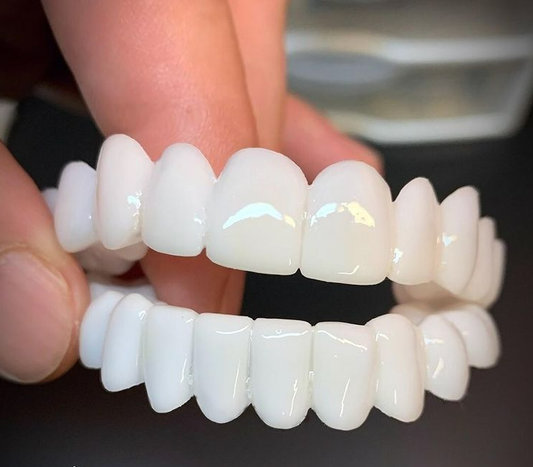 Carillas Dentales DentAlign – Ajuste Natural y Comodidad