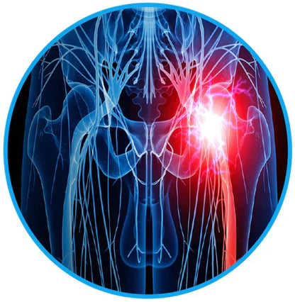 Cinturón para Alivio del Dolor Ciático - elimina tu ciática y dolor lumbar