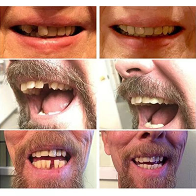 Dientes postizos de alta calidad
