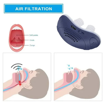 Dispositivo Anti-Ronquidos Micro-CPAP Sin Máscara y Sin Insomnio