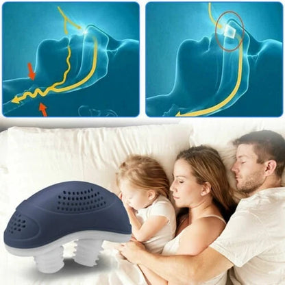 Dispositivo Anti-Ronquidos Micro-CPAP Sin Máscara y Sin Insomnio