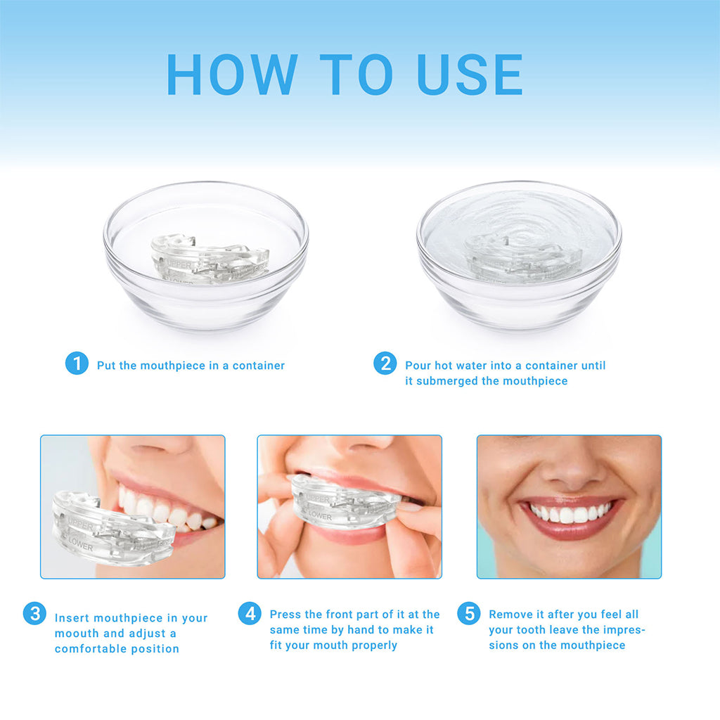 Dispositivo Antisnore SilentForm – Ajustable, Confort Optimizado, Solución Efectiva para el Sueño