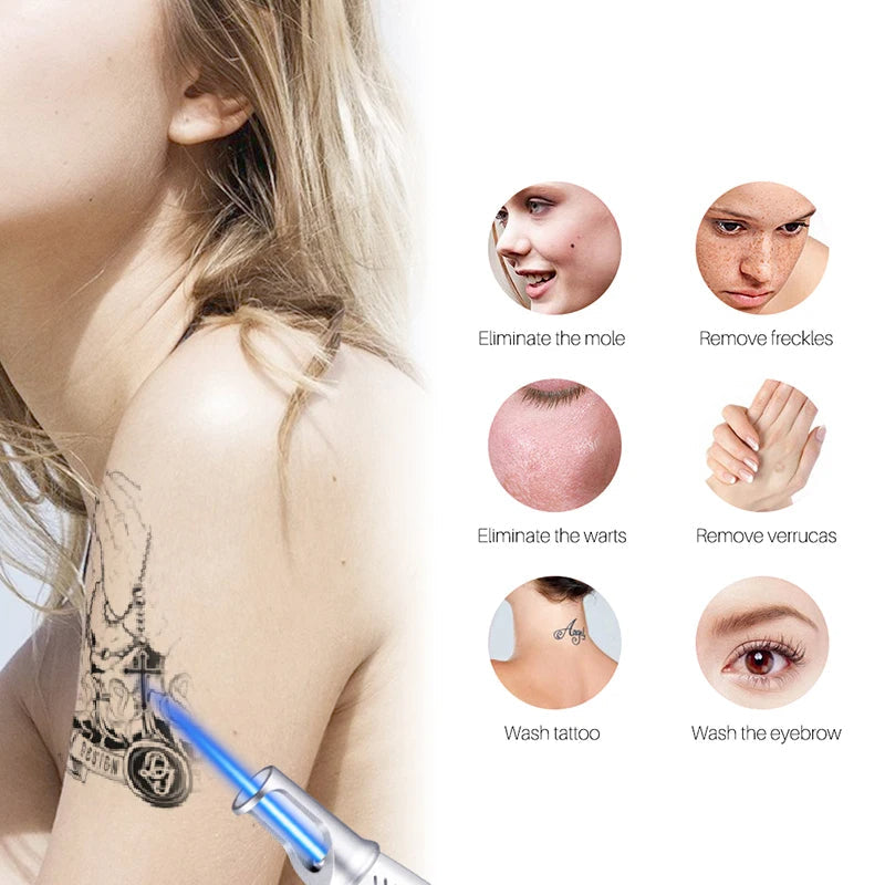 Lápiz Láser LumiDerm para la Eliminación de Tatuajes, Lunares y Pecas