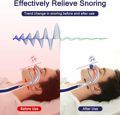 Máquina Micro CPAP para Apnea del Sueño para Viajes y Anti-Ronquidos - Alternativa a CPAP