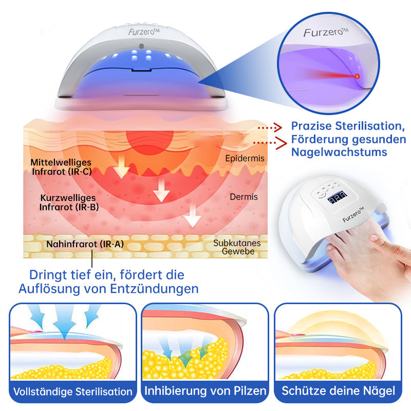 NailCure™ - Solución de Tratamiento Láser para Hongos en las Uñas (50% DESCUENTO)