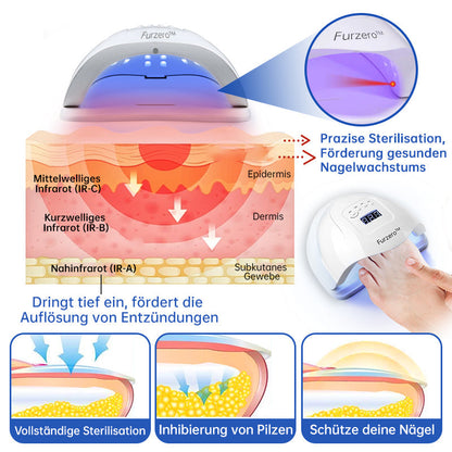 NailCure™ - Solución de Tratamiento Láser para Hongos en las Uñas (50% DESCUENTO)