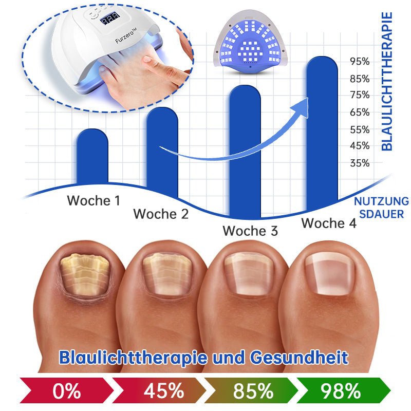 NailCure™ - Solución de Tratamiento Láser para Hongos en las Uñas (50% DESCUENTO)