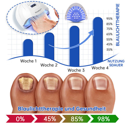 NailCure™ - Solución de Tratamiento Láser para Hongos en las Uñas (50% DESCUENTO)