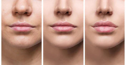 Suero Instantáneo para Aumentar los Labios