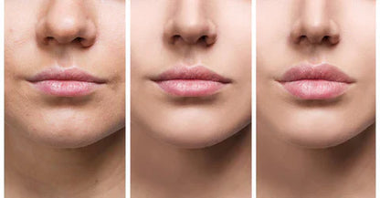 Suero Instantáneo para Aumentar los Labios