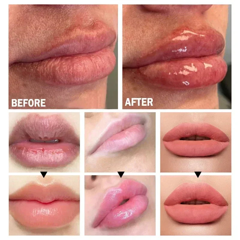 Suero Instantáneo para Aumentar los Labios