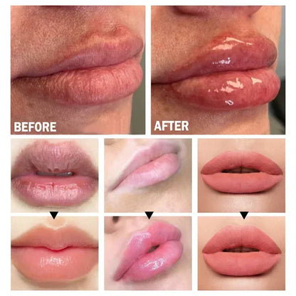 Suero Instantáneo para Aumentar los Labios