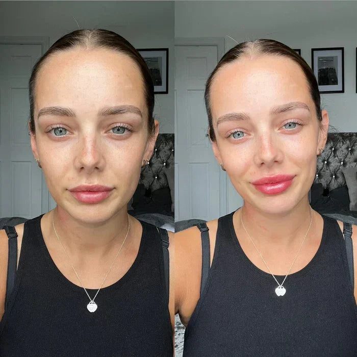 Suero Instantáneo para Aumentar los Labios
