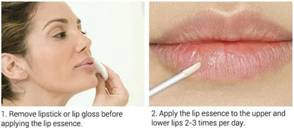 Suero Instantáneo para Aumentar los Labios