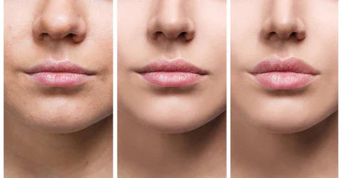 Suero Voluminizador de Labios LumaGlow Instantáneo para Labios Más Llenos