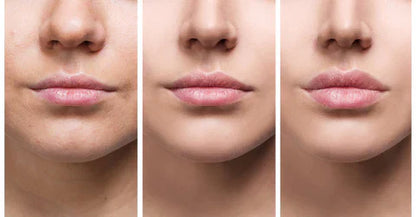Suero Voluminizador de Labios LumaGlow Instantáneo para Labios Más Llenos