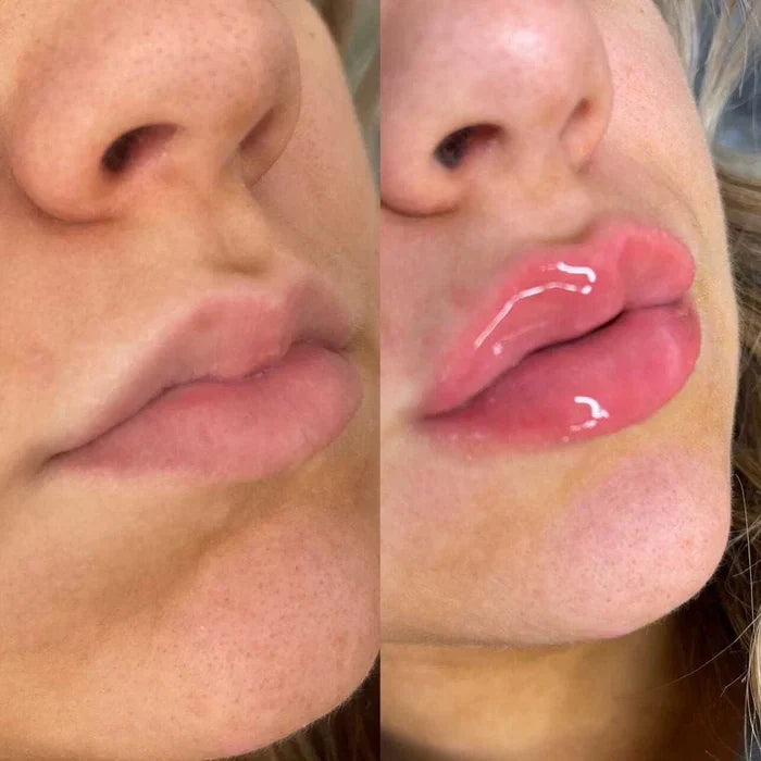 Suero Voluminizador de Labios LumaGlow Instantáneo para Labios Más Llenos