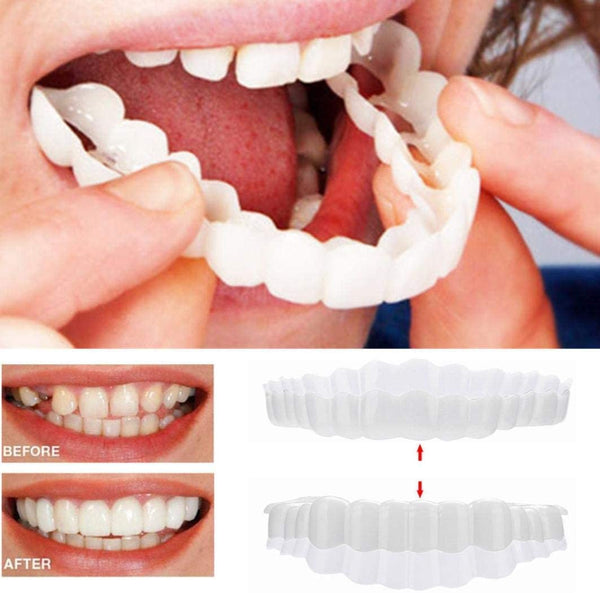 VierraSol | Carillas de Sonrisa (Incluye Mandíbula Superior e Inferior)