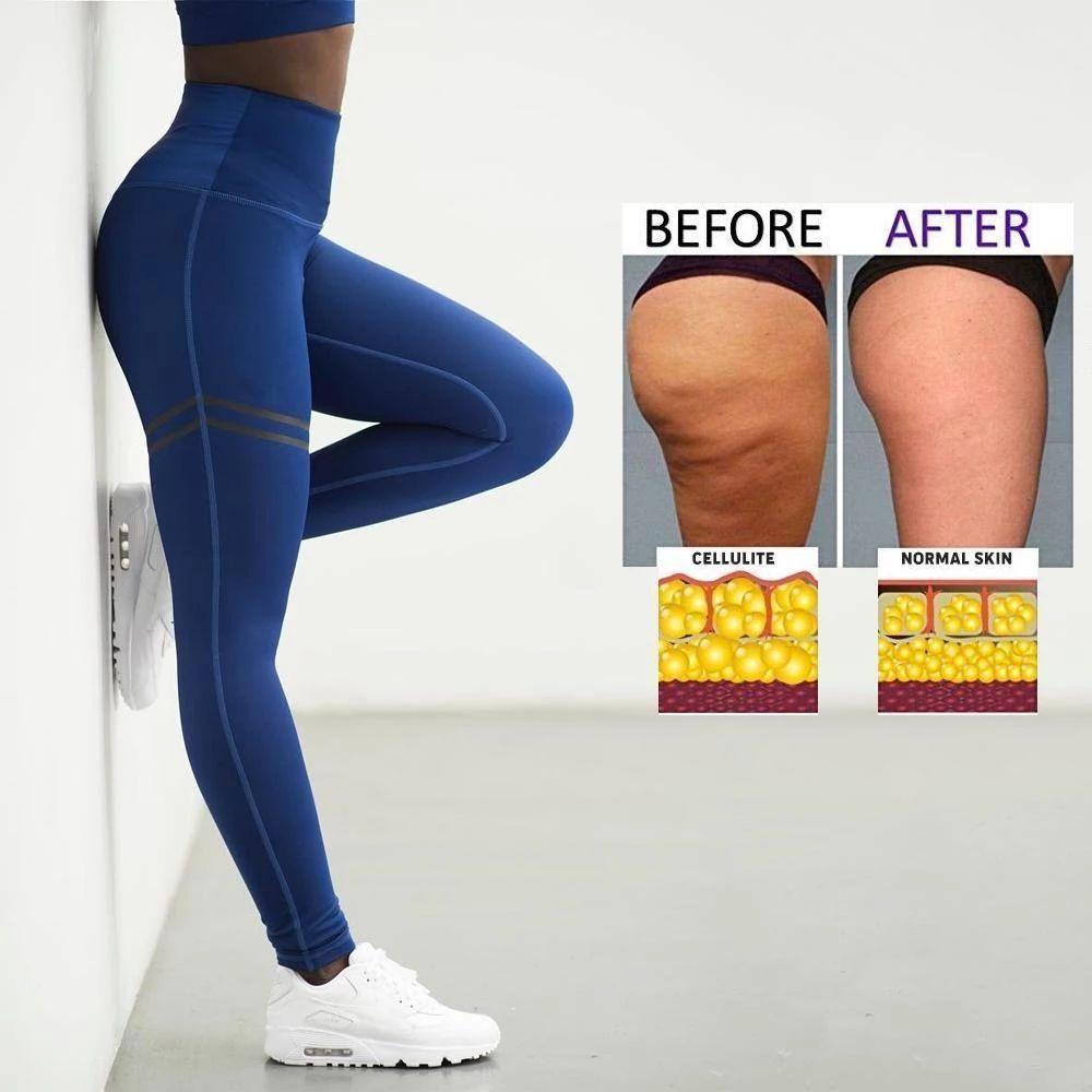 VierraSol | Leggings de Compresión Anticelulitis para Mujer