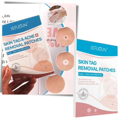 VierraSol | Parche para la piel - ¡Elimina lunares y verrugas de forma natural!