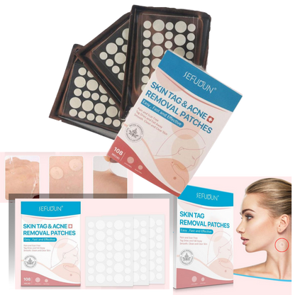 VierraSol | Parche para la piel - ¡Elimina lunares y verrugas de forma natural!