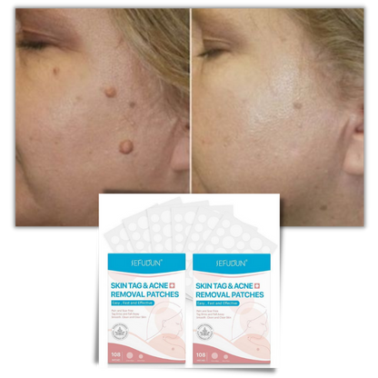 VierraSol | Parche para la piel - ¡Elimina lunares y verrugas de forma natural!